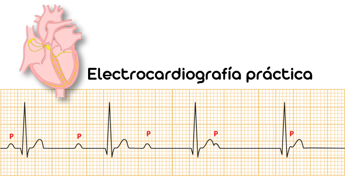 Electrocardiografía práctica